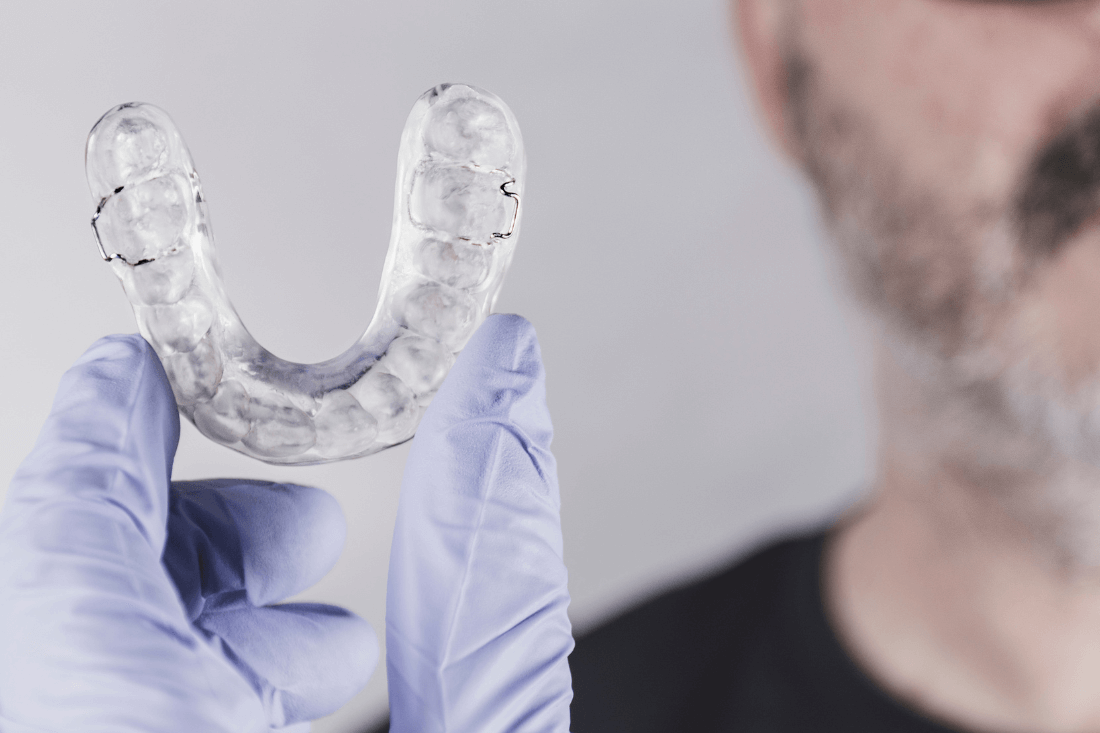 El impacto del estrés en la salud bucodental: bruxismo y otros problemas asociados