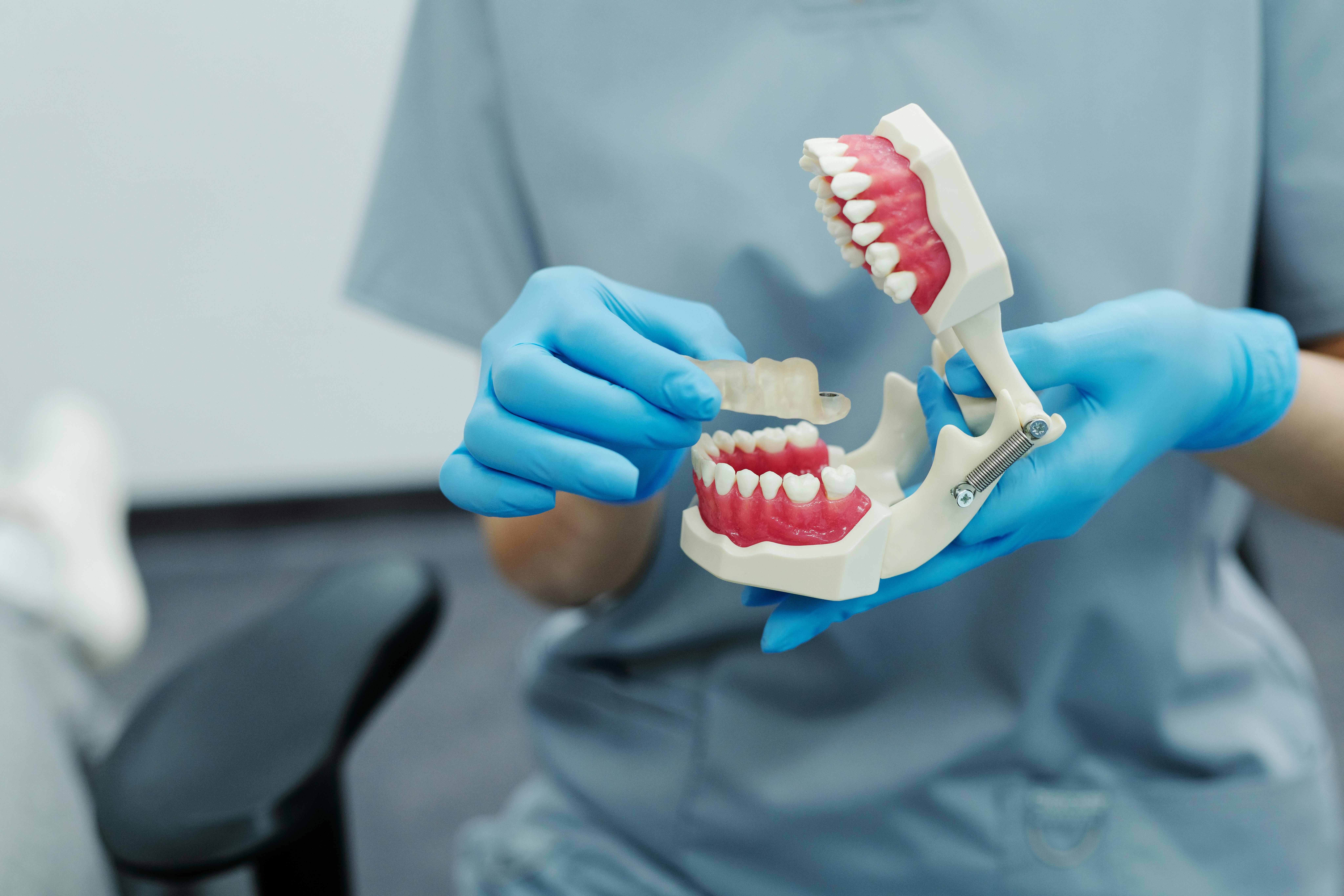 Prótesis dental en Madrid