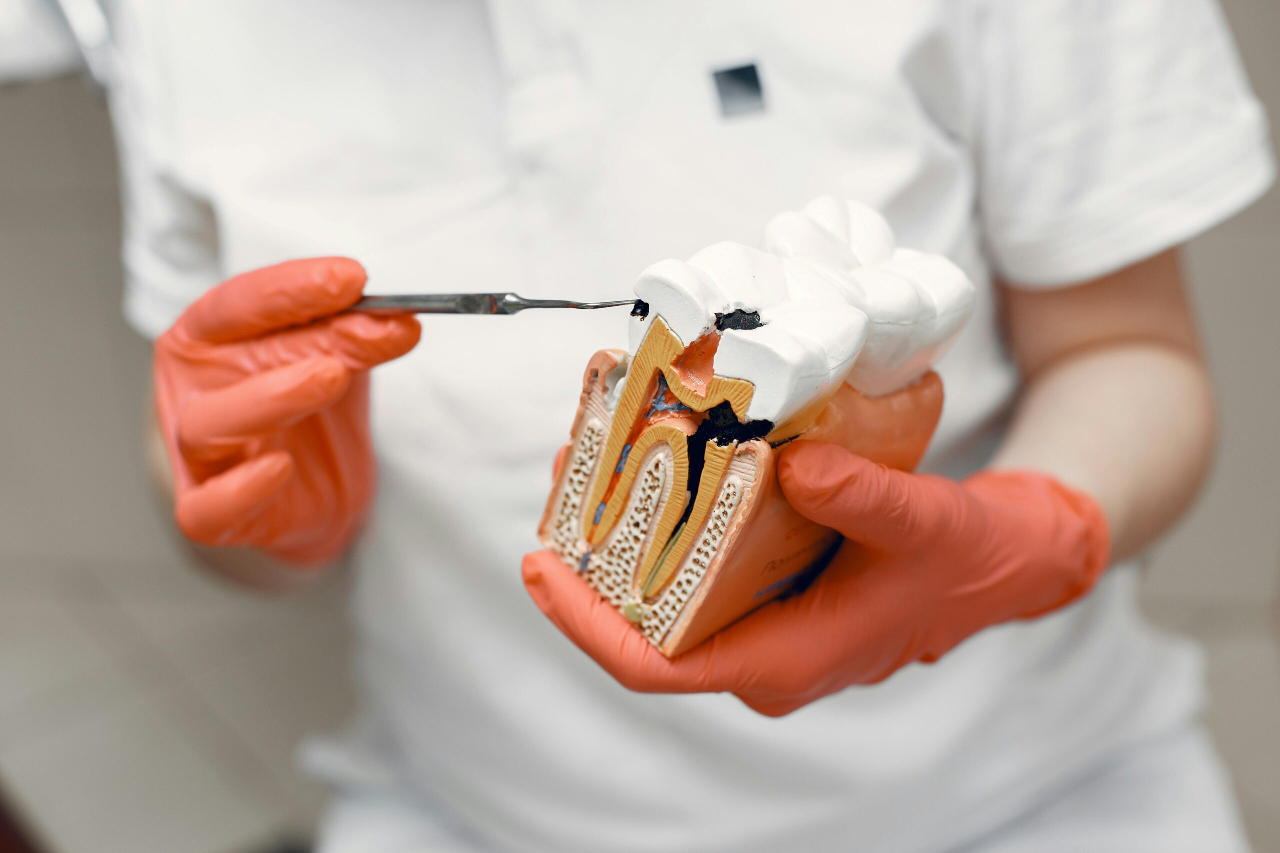 Endodoncia en Madrid