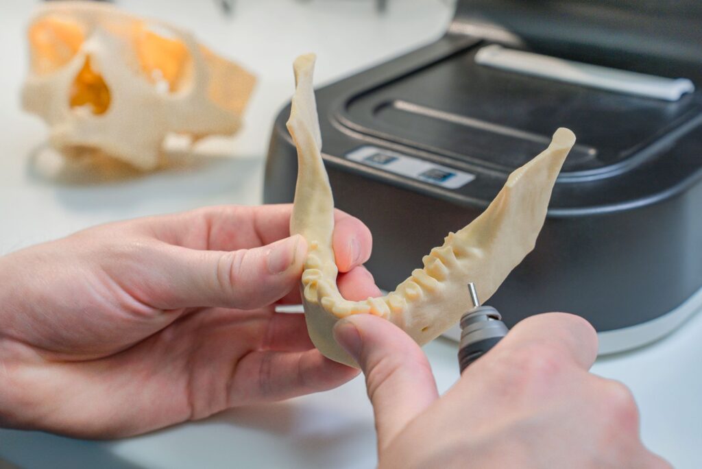 Duele ponerse realmente un implante dental