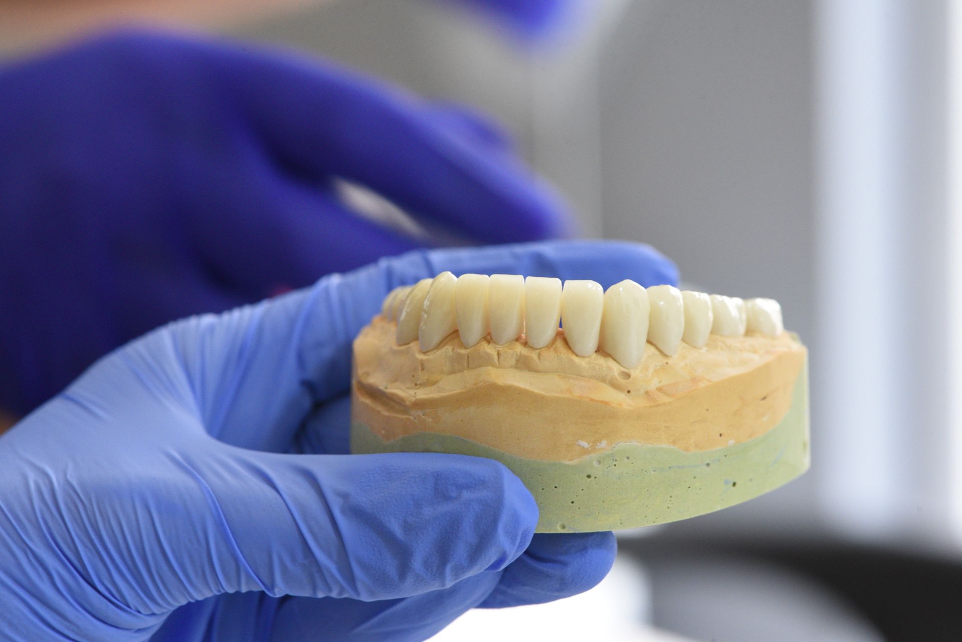 ¿Duele ponerse un implante dental?