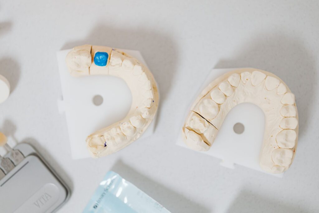 ponerse un implante dental