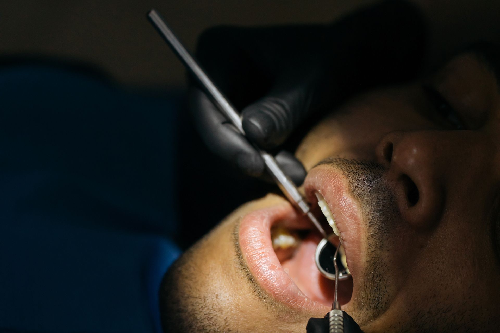 Cuidados después de un implante dental