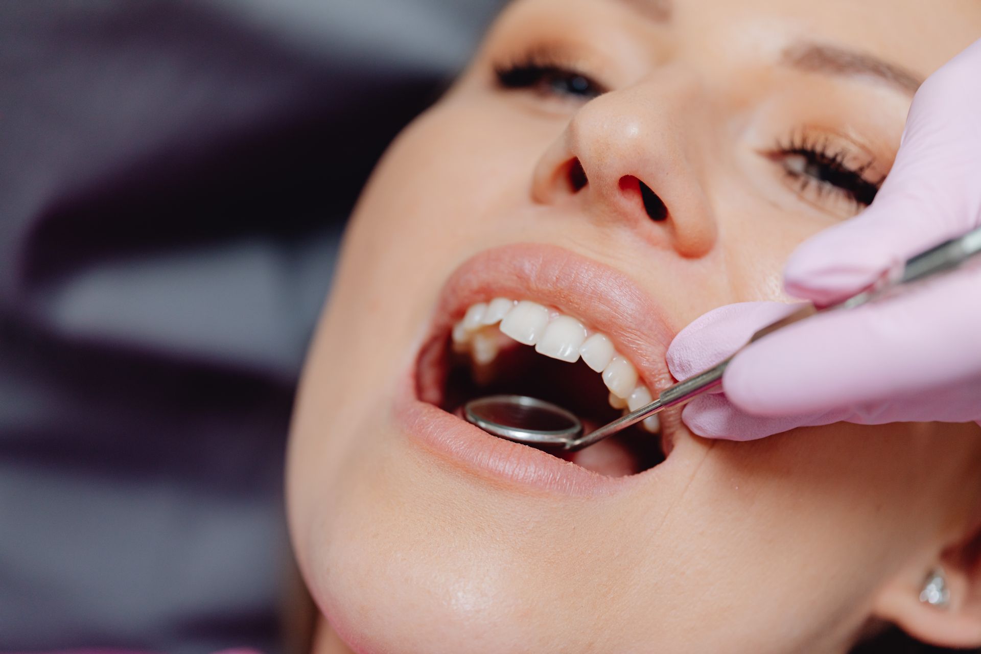 ¿Cómo saber si una caries ha llegado al nervio?